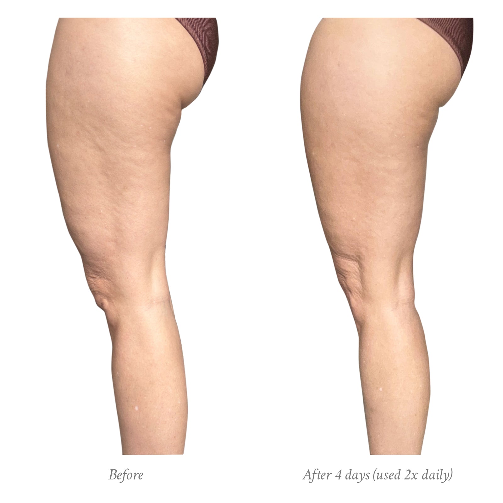 Age-Defying Body Treatment