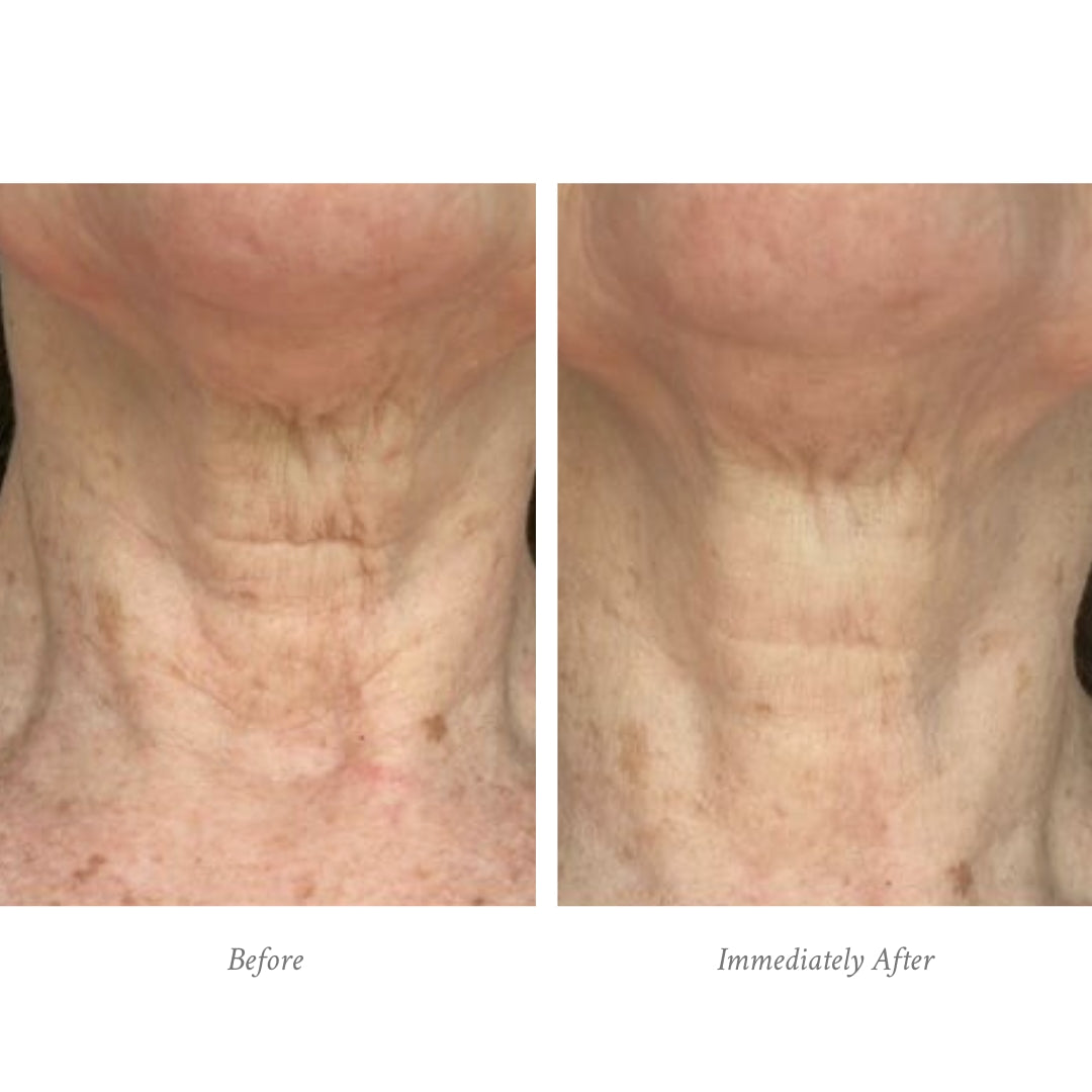 Age-Defying Body Treatment