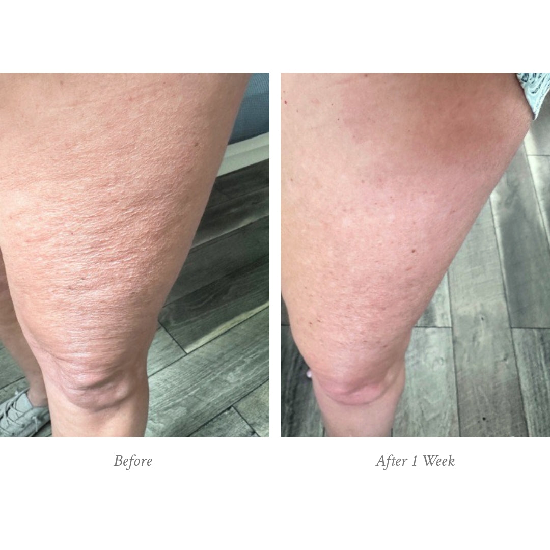 Age-Defying Body Treatment