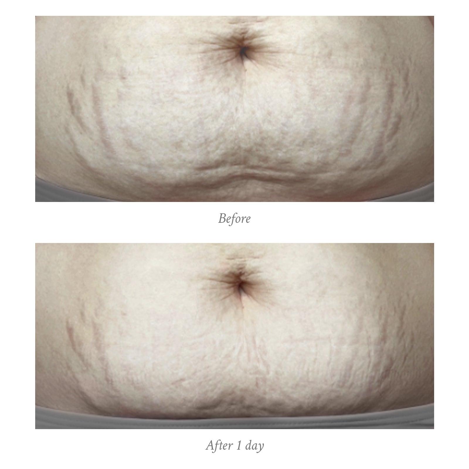 Age-Defying Body Treatment