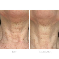 Age Defying Body Treatment