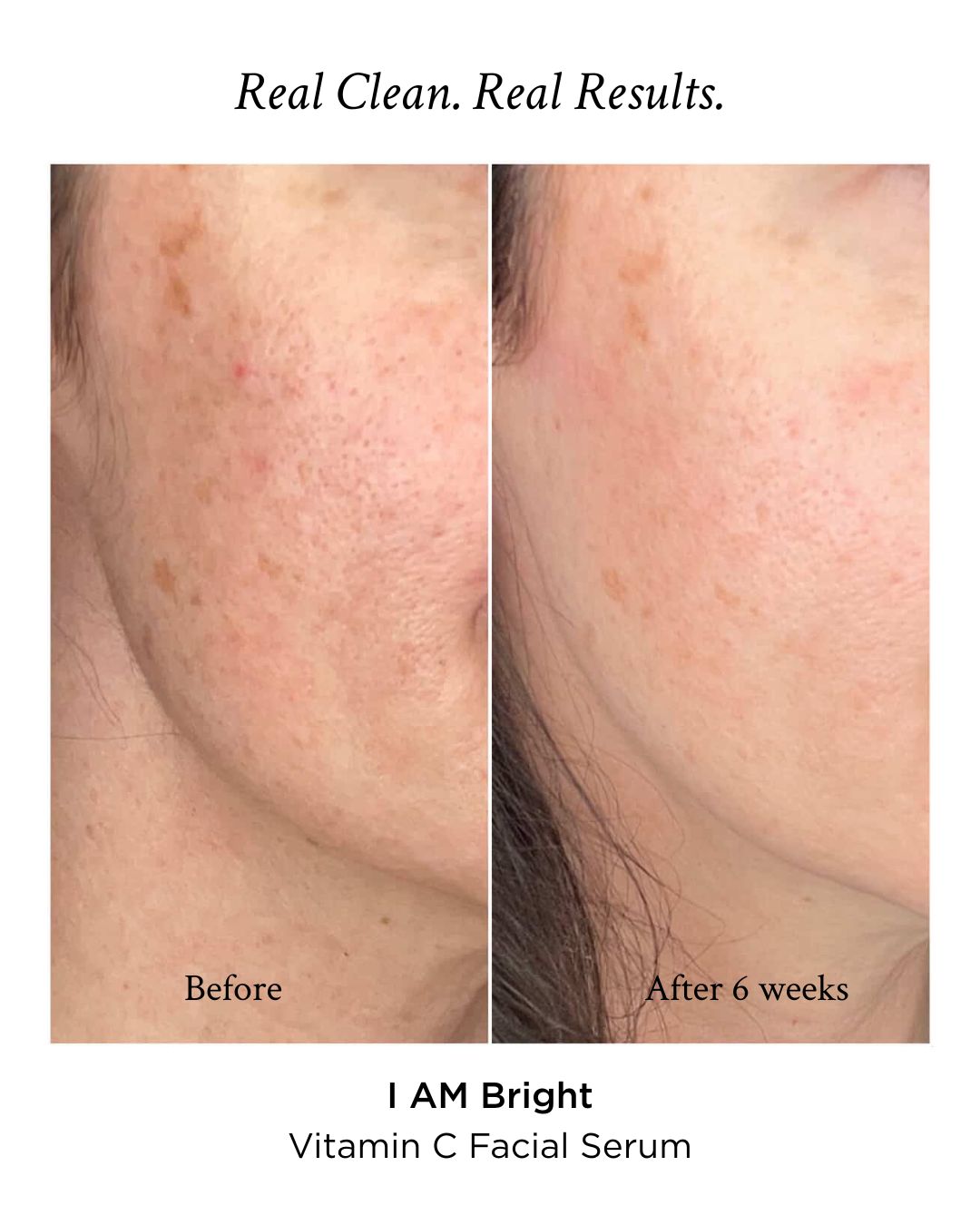 I AM Bright® Vitamin C Facial Serum